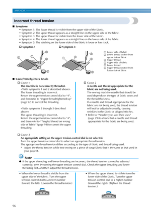 Page 9896
APPENDIX ————————————————————————————————————————————————————————————————————————————————————————————————————————————
Incorrect thread tension
■Symptoms
 Symptom 1: The lower thread is visible from the upper side of the fabric.
 Symptom 2: The upper thread appears as a straight line on the upper side of the fabric.
 Symptom 3: The upper thread is visible from the lower side of the fabric.
 Symptom 4: The lower thread appears as a straight line on the lower side of the fabric.
 Symptom 5: The stitching...