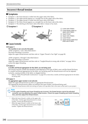 Page 348TROUBLESHOOTING
346
Incorrect thread tension
■Symptoms
• Symptom 1: The lower thread is visible from the upper side of the fabric.
• Symptom 2: The upper thread appears as a straight line on the upper side of the fabric.
• Symptom 3: The upper thread is visible from the lower side of the fabric.
• Symptom 4: The lower thread appears as a straight line on the lower side of the fabric.
• Symptom 5: The stitching on the lower side of the fabric is loose or has slack.
■Cause/remedy
□ Cause 1
The machine is...