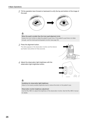 Page 2626
4 Basic Operations
2 Tilt the operation lever forward or backward to unify the top and bottom of the image of 
the pupil. 
When the pupil is smaller than the inner pupil alignment circle 
Darken the room further to dilate the patient's pupil more. If the patient's pupil does not dilate 
enough, use the small pupil photography function (see page 30). 
3 Press the alignment button. 
The retina appears in the observation monitor and the internal 
eye fixation lamp blinks for three seconds. 
4...