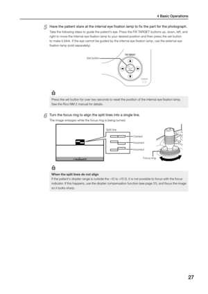 Page 274 Basic Operations
27
5 Have the patient stare at the internal eye fixation lamp to fix the part for the photograph. 
Take the following steps to guide the patient’s eye. Press the FIX TARGET buttons up, down, left, and 
right to move the internal eye fixation lamp to your desired position and then press the set button 
to make it blink. If the eye cannot be guided by the internal eye fixation lamp, use the external eye 
fixation lamp (sold separately). 
Set button 
Press the set button for over two...