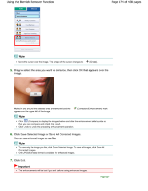 Page 174Note
Move the cursor over the image. The shape of the cursor changes to  (Cross).
5.Drag to select the area you want to enhance, then c lick OK that appears over the
image.
Moles in and around the selected area are removed a nd the  (Correction/Enhancement) mark
appears on the upper left of the image.
Note
Click  (Compare) to display the images before and after t he enhancement side by side so
that you can compare and check the result.
Click Undo to undo the preceding enhancement operat ion.
6.Click Save...