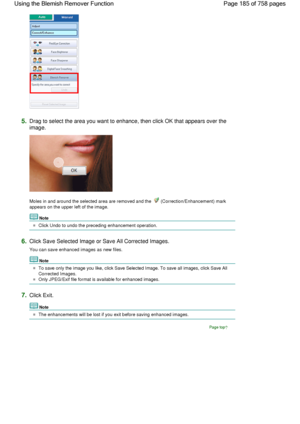 Page 1855.Drag to select the area you want to enhance, then click OK that appears over the
image.
Moles in and around the selected area are removed and the  (Correction/Enhancement) mark
appears on the upper left of the image.
Note
Click Undo to undo the preceding enhancement operation.
6.Click Save Selected Image or Save All Corrected Images.
You can save enhanced images as new files.
Note
To save only the image you like, click Save Selected Image. To save all images, click Save All
Corrected Images.
Only...