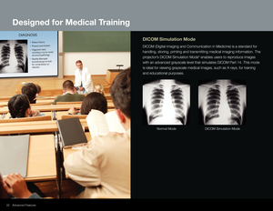 Page 2222
DICOM Simulation Mode
DICOM (Digital Imaging and Communication in Medicine) is a standard for 
handling, storing, printing and transmitting medical imaging information\
. The 
projector’s DICOM Simulation Mode
5 enables users to reproduce images 
with an advanced grayscale level that simulates DICOM Part 14. This mode\
 
is ideal for viewing grayscale medical images, such as X-rays, for train\
ing 
and educational purposes.
Normal Mode DICOM Simulation Mode
Advanced Features
Designed for Medical...