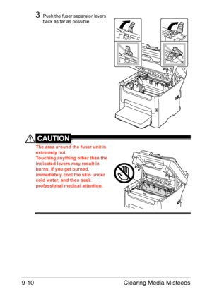 Page 221Clearing Media Misfeeds 9-10
3Push the fuser separator levers 
back as far as possible.
CAUTION
The area around the fuser unit is 
extremely hot.
Touching anything other than the 
indicated levers may result in 
burns. If you get burned, 
immediately cool the skin under 
cold water, and then seek 
professional medical attention.
Downloaded From ManualsPrinter.com Manuals 