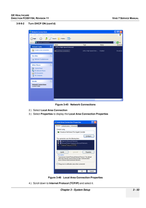 Page 177
GE HEALTHCARE
DIRECTION FC091194, REVISION 11    VIVID 7 SERVICE MANUAL 
Chapter 3 - System Setup 3 - 53
3-9-9-2      Turn DHCP ON (cont’d) 2.) Select Local Area Connection
3.) Select  Properties  to display the  Local Area Connection Properties
4.) Scroll down to  Internet Protocol (TCP/IP)  and select it.
Figure 3-45   Network Connections 
Figure 3-46   Local Area Connection Properties 