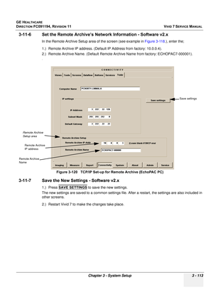 Page 237
GE HEALTHCARE
DIRECTION FC091194, REVISION 11    VIVID 7 SERVICE MANUAL 
Chapter 3 - System Setup 3 - 113
3-11-6 Set the Remote Archive’s Ne twork Information - Software v2.x
In the Remote Archive Setup area of the screen (see example in  Figure 3-118.), enter the;
1.) Remote Archive IP address. (Default  IP Address from factory: 10.0.0.4).
2.) Remote Archive Name. (Default Remote Ar chive Name from factory: ECHOPAC7-000001).
.
3-11-7 Save the New Settings - Software v2.x
1.) Press SAVE SETTINGS to save...