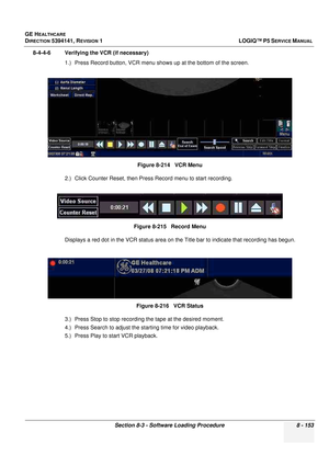 Page 399GE HEALTHCARE
DIRECTION 5394141, REVISION  1LOGIQ™ P5 SERVICE MANUAL 
Section 8-3 - Software Loading Procedure 8 - 153
8-4-4-6 Verifying the VCR (if necessary) 1.) Press Record button, VCR menu shows up at the bottom of the screen.
2.) Click Counter Reset, then Press  Record menu to start recording.
Displays a red dot in the VCR status area on the Title bar to indicate that recording has begun.
3.) Press Stop to stop recording the tape at the desired moment.
4.) Press Search to adjust the st arting time...