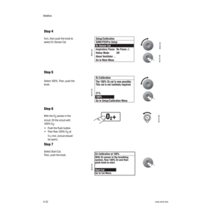 Page 72Aestiva
4-221006-0939-000
4-22
Step 4
 
Turn, then push the knob to 
select O
2 Sensor Cal.
Step 5
Select 100%. Then, push the 
knob. 
Step 6
With the O
2 sensor in the 
circuit, fill the circuit with 
100% O
2:
•Push the flush button. 
•Then flow 100% O
2 at 
5 L/min. (circuit should 
be open).
Step 7
Select Start Cal.
Then, push the knob.
AB29.002 AB.29.046
AB90.048
AB.90.050
AB.90.088
AB48.081
  