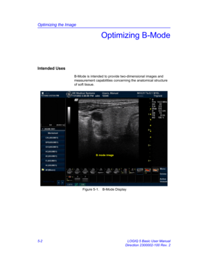 Page 126Optimizing the Image
5-2 LOGIQ 5 Basic User Manual
Direction 2300002-100 Rev. 2
Optimizing B-Mode
Intended Uses
B-Mode is intended to provide two-dimensional images and 
measurement capabilities concerning the anatomical structure 
of soft tissue. 
 Figure 5-1. B-Mode Display 