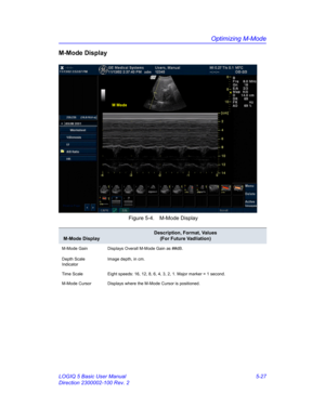 Page 151Optimizing M-Mode
LOGIQ 5 Basic User Manual 5-27
Direction 2300002-100 Rev. 2
M-Mode Display
 Figure 5-4. M-Mode Display
M-Mode Display
Description, Format, Values
(For Future Vadliation)
M-Mode Gain
Depth Scale  
IndicatorDisplays Overall M-Mode Gain as ##dB. 
Image depth, in cm.
Time Scale Eight speeds: 16, 12, 8, 6, 4, 3, 2, 1. Major marker = 1 second. 
M-Mode Cursor Displays where the M-Mode Cursor is positioned.  