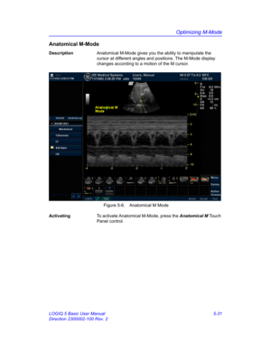 Page 155Optimizing M-Mode
LOGIQ 5 Basic User Manual 5-31
Direction 2300002-100 Rev. 2
Anatomical M-Mode
DescriptionAnatomical M-Mode gives you the ability to manipulate the 
cursor at different angles and positions. The M-Mode display 
changes according to a motion of the M cursor.
 Figure 5-6. Anatomical M Mode
ActivatingTo activate Anatomical M-Mode, press the Anatomical M Touch 
Panel control.   