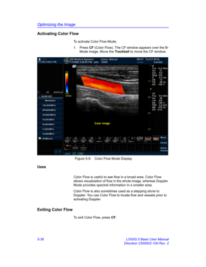 Page 160Optimizing the Image
5-36 LOGIQ 5 Basic User Manual
Direction 2300002-100 Rev. 2
Activating Color Flow
To activate Color Flow Mode, 
1. Press CF (Color Flow). The CF window appears over the B-
Mode image. Move the Trackball to move the CF window.
 Figure 5-9. Color Flow Mode Display
Uses
Color Flow is useful to see flow in a broad area. Color Flow 
allows visualization of flow in the whole image, whereas Doppler 
Mode provides spectral information in a smaller area. 
Color Flow is also sometimes used as...