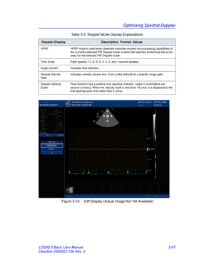 Page 181Optimizing Spectral Doppler
LOGIQ 5 Basic User Manual 5-57
Direction 2300002-100 Rev. 2 Figure 5-16. CW Display (Actual Image Not Yet Available)
HPRF HPRF mode is used when detected velocities exceed the processing capabilities of 
the currently selected PW Doppler scale or when the selected anatomical site is too 
deep for the selected PW Doppler scale. 
Time Scale Eight speeds: 12, 8, 6, 5, 4, 3, 2, and 1 second sweeps. 
Angle Correct Indicates flow direction. 
Sample Volume 
GateIndicates sample...