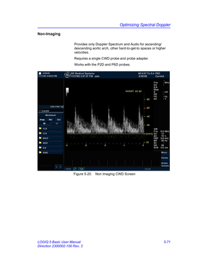 Page 195Optimizing Spectral Doppler
LOGIQ 5 Basic User Manual 5-71
Direction 2300002-100 Rev. 2
Non-Imaging
Provides only Doppler Spectrum and Audio for ascending/
descending aortic arch, other hard-to-get-to spaces or higher 
velocities.
Requires a single CWD probe and probe adapter.
Works with the P2D and P6D probes.
 Figure 5-20. Non Imaging CWD Screen 