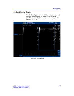 Page 217Using CINE
LOGIQ 5 Basic User Manual 6-7
Direction 2300002-100 Rev. 2
CINE and Monitor Display
The CINE display (located on the left-hand side of the monitor) 
indicates which frame you are viewing of the whole loop 
(62:123), as well as the time at which this frame occurs within 
the loop (1.6:3.2 s). 
 Figure 6-1. CINE Display 