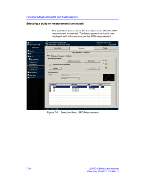 Page 270General Measurements and Calculations
7-20 LOGIQ 5 Basic User Manual
Direction 2300002-100 Rev. 2
Selecting a study or measurement (continued)
The illustration below shows the Selection menu after the BPD 
measurement is selected. The Measurement section is now 
displayed, with information about the BPD measurement. 
 Figure 7-9. Selection Menu: BPD Measurement 