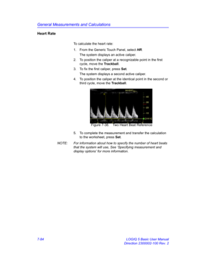 Page 334General Measurements and Calculations
7-84 LOGIQ 5 Basic User Manual
Direction 2300002-100 Rev. 2
Heart Rate
To calculate the heart rate:
1.  From the Generic Touch Panel, select HR. 
The system displays an active caliper. 
2.  To position the caliper at a recognizable point in the first 
cycle, move the Trackball.
3.  To fix the first caliper, press Set.
The system displays a second active caliper.
4.  To position the caliper at the identical point in the second or 
third cycle, move the Trackball....