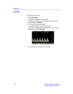 Page 398OB/GYN
9-32 LOGIQ 5 Basic User Manual
Direction 2300002-100 Rev. 2
Heart Rate
To calculate the heart rate:
1. Select Heart Rate. 
The system displays an active caliper. 
2.  To position the caliper at a recognizable point in the first 
cycle, move the Trackball.
3.  To fix the first caliper, press Set.
The system displays a second active caliper.
4.  To position the caliper at the identical point in the second or 
third cycle, move the Trackball.
 Figure 9-3. Two Heart Beat Reference
5.  To complete the...