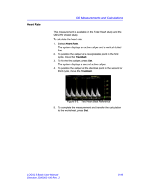 Page 415OB Measurements and Calculations
LOGIQ 5 Basic User Manual 9-49
Direction 2300002-100 Rev. 2
Heart Rate
This measurement is available in the Fetal Heart study and the 
OB/GYN Vessel study.
To calculate the heart rate:
1. Select Heart Rate. 
The system displays an active caliper and a vertical dotted 
line. 
2.  To position the caliper at a recognizable point in the first 
cycle, move the Trackball.
3.  To fix the first caliper, press Set.
The system displays a second active caliper.
4.  To position the...