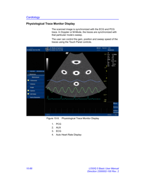 Page 556Cardiology
10-86 LOGIQ 5 Basic User Manual
Direction 2300002-100 Rev. 2
Physiological Trace Monitor Display
The scanned image is synchronized with the ECG and PCG 
trace. In Doppler or M-Mode, the traces are synchronized with 
that particular mode’s sweep.
The user can control the gain, position and sweep speed of the 
traces using the Touch Panel controls.
 Figure 10-9. Physiological Trace Monitor Display
1. PCG
2. AUX
3. ECG
4.  Auto Heart Rate Display 