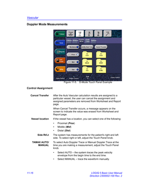 Page 576Vascular
11-16 LOGIQ 5 Basic User Manual
Direction 2300002-100 Rev. 2
Doppler Mode Measurements
 Figure 11-5. D-Mode Touch Panel Example
Control Assignment
Cancel TransferAfter the Auto Vascular calculation results are assigned to a 
particular vessel, the user can cancel the assignment and 
assigned parameters are removed from Worksheet and Report 
page.
When Cancel Transfer occurs, a message appears on the 
screen to indicate the value was erased from Worksheet and 
Report page.
Vessel locationIf the...