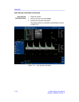 Page 582Vascular
11-22 LOGIQ 5 Basic User Manual
Direction 2300002-100 Rev. 2
Auto Vascular Calculation (continued)
Auto Vascular
Calculation Exam1. Preset the system.
2.  Perform the scan and press Freeze.
3.  Activate Auto Vascular Calculation.
The system performs a calculation automatically as shown 
in Figure 11-8.
 Figure 11-8. Auto Vascular Calculation 