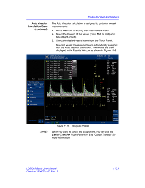 Page 583Vascular Measurements
LOGIQ 5 Basic User Manual 11-23
Direction 2300002-100 Rev. 2Auto Vascular
Calculation Exam
(continued)The Auto Vascular calculation is assigned to particular vessel 
measurements.
1. Press Measure to display the Measurement menu.
2.  Select the location of the vessel (Prox, Mid, or Dist) and 
Side (Right or Left).
3.  Select the desired vessel name from the Touch Panel. 
Selected vessel measurements are automatically assigned 
with the Auto Vascular calculation. The results are then...