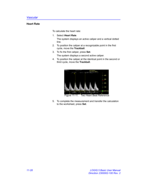 Page 588Vascular
11-28 LOGIQ 5 Basic User Manual
Direction 2300002-100 Rev. 2
Heart Rate
To calculate the heart rate:
1. Select Heart Rate. 
The system displays an active caliper and a vertical dotted 
line. 
2.  To position the caliper at a recognizable point in the first 
cycle, move the Trackball.
3.  To fix the first caliper, press Set.
The system displays a second active caliper.
4.  To position the caliper at the identical point in the second or 
third cycle, move the Trackball.
 Figure 11-11. Two Heart...