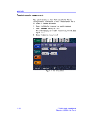 Page 592Vascular
11-32 LOGIQ 5 Basic User Manual
Direction 2300002-100 Rev. 2
To select vascular measurements
Your system is set up to show the measurements that you 
usually make for each vessel. To make a measurement that is 
not shown for the selected vessel:
1.  Select the folder for the vessel you want to measure.
2. Select Show All. See Figure 11-12.
The system displays all possible vessel measurements. See 
Figure 11-13.
3.  Select the desired measurement.
 Figure 11-12. ECA folder 