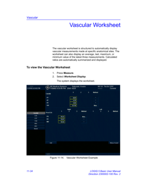 Page 594Vascular
11-34 LOGIQ 5 Basic User Manual
Direction 2300002-100 Rev. 2
Vascular Worksheet
The vascular worksheet is structured to automatically display 
vascular measurements made at specific anatomical sites. The 
worksheet can also display an average, last, maximum, or 
minimum value of the latest three measurements. Calculated 
ratios are automatically summarized and displayed.
To view the Vascular Worksheet
1. Press Measure.
2. Select Worksheet Display.
The system displays the worksheet.
 Figure...