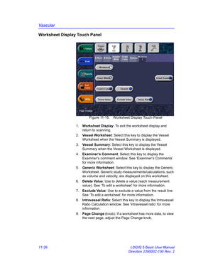 Page 596Vascular
11-36 LOGIQ 5 Basic User Manual
Direction 2300002-100 Rev. 2
Worksheet Display Touch Panel
 Figure 11-15. Worksheet Display Touch Panel
1. Worksheet Display: To exit the worksheet display and 
return to scanning.
2. Vessel Worksheet: Select this key to display the Vessel 
Worksheet when the Vessel Summary is displayed.
3. Vessel Summary: Select this key to display the Vessel 
Summary when the Vessel Worksheet is displayed.
4. Examiner’s Comment: Select this key to display the 
Examiner’s comment...