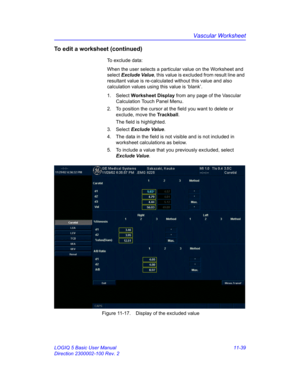 Page 599Vascular Worksheet
LOGIQ 5 Basic User Manual 11-39
Direction 2300002-100 Rev. 2
To edit a worksheet (continued)
To exclude data: 
When the user selects a particular value on the Worksheet and 
select Exclude Value, this value is excluded from result line and 
resultant value is re-calculated without this value and also 
calculation values using this value is ‘blank’.
1. Select Worksheet Display from any page of the Vascular 
Calculation Touch Panel Menu.
2.  To position the cursor at the field you want...