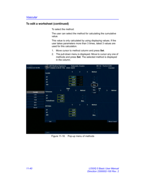 Page 600Vascular
11-40 LOGIQ 5 Basic User Manual
Direction 2300002-100 Rev. 2
To edit a worksheet (continued)
To select the method:
The user can select the method for calculating the cumulative 
value.
This value is only calculated by using displaying values. If the 
user takes parameters more than 3 times, latest 3 values are 
used for this calculation.
1.  Move cursor to method column and press Set. 
2.  The pull-down menu is displayed. Move to cursor any one of 
methods and press Set. The selected method is...