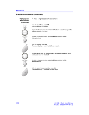 Page 614Pediatrics
13-6 LOGIQ 5 Basic User Manual
Direction 2300002-100 Rev. 2
B-Mode Measurements (continued)
Hip Dysplasia
Measurement
(continued)To make a Hip Dysplasia measurement: 
MeasureFrom the Touch Panel, select HIP. 
A horizontal dotted line displays. 
To place the baseline, move the Trackball. Position the crosshairs edge at the 
osseous convexity of the ilium.
To rotate or change inclination, adjust the Ellipse control or the Hip 
Orientation knob. 
SetTo fix the baseline, press Set. 
The system...