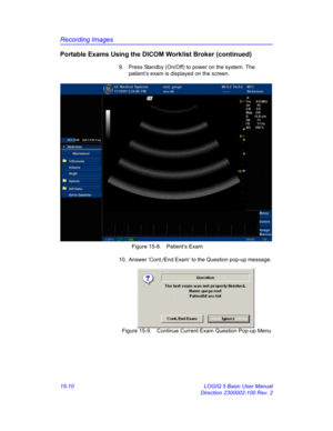 Page 630Recording Images
15-10 LOGIQ 5 Basic User Manual
Direction 2300002-100 Rev. 2
Portable Exams Using the DICOM Worklist Broker (continued)
9.  Press Standby (On/Off) to power on the system. The 
patient’s exam is displayed on the screen. 
 Figure 15-8. Patient’s Exam
10.  Answer ‘Cont./End Exam’ to the Question pop-up message. 
 Figure 15-9. Continue Current Exam Question Pop-up Menu 