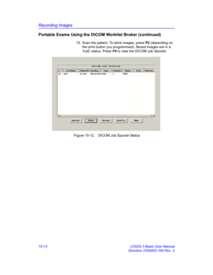 Page 632Recording Images
15-12 LOGIQ 5 Basic User Manual
Direction 2300002-100 Rev. 2
Portable Exams Using the DICOM Worklist Broker (continued)
13.  Scan the patient. To store images, press P2 (depending on 
the print button you programmed). Stored images are in a 
‘hold’ status. Press F4 to view the DICOM Job Spooler. 
 Figure 15-12. DICOM Job Spooler Status 