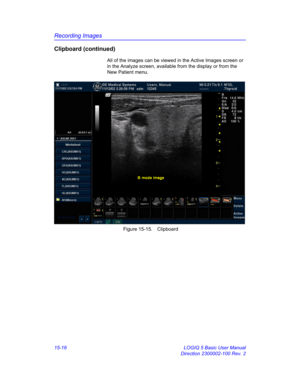 Page 636Recording Images
15-16 LOGIQ 5 Basic User Manual
Direction 2300002-100 Rev. 2
Clipboard (continued)
All of the images can be viewed in the Active Images screen or 
in the Analyze screen, available from the display or from the 
New Patient menu. 
 Figure 15-15. Clipboard 