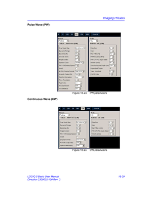 Page 699Imaging Presets
LOGIQ 5 Basic User Manual 16-39
Direction 2300002-100 Rev. 2
Pulse Wave (PW)
 Figure 16-23. PW parameters
Continuous Wave (CW)
 Figure 16-24. CW parameters 