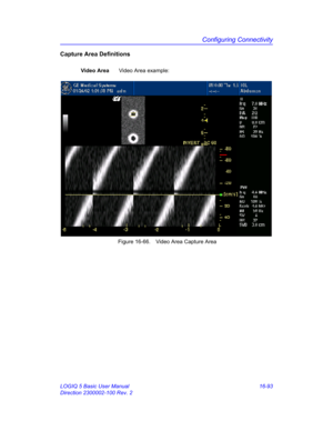 Page 753Configuring Connectivity
LOGIQ 5 Basic User Manual 16-93
Direction 2300002-100 Rev. 2
Capture Area Definitions
Video AreaVideo Area example: 
 Figure 16-66. Video Area Capture Area 