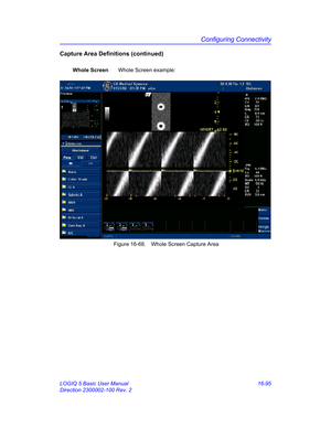 Page 755Configuring Connectivity
LOGIQ 5 Basic User Manual 16-95
Direction 2300002-100 Rev. 2
Capture Area Definitions (continued)
Whole ScreenWhole Screen example: 
 Figure 16-68. Whole Screen Capture Area 