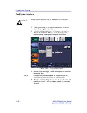 Page 822Probes and Biopsy
17-40 LOGIQ 5 Basic User Manual
Direction 2300002-100 Rev. 2
The Biopsy Procedure
1.  Place coupling gel on the scanning surface of the probe/
sheath/biopsy guide assembly.
2.  Activate the biopsy guidezone on the system through the 
B-Mode Touch Panel.  When using multi-angle guides, 
ensure that the proper guidezone angle is displayed.
 Figure 17-23. B-Mode Touch Panel
3.  Scan to locate the target.  Center the target in the electronic 
guidezone path.
NOTE:  Enabling color flow would...