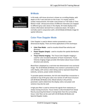 Page 24 GE Logiq E9/Vivid E9 Training Manual 
© 2016 Conquest Imaging 17 
M-Mode 
In M-mode, soft tissue structure is shown as a scrolling display, with 
depth on the Y-axis and time on the X-axis. It is mostly used for 
cardiac measurements. M-mode is also known as T-M mode or Time-
Motion mode. Ultrasound echoes of different intensities are mapped 
to different gray scale values in the display. M-mode displays time 
motion information derived from a stationary beam. M-mode is 
normally used in conjunction...