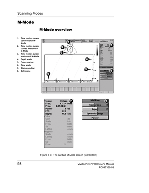 Page 112Scanning Modes
98Vivid7/Vivid7 PRO Users Manual
FC092326-03
M-Mode
M-Mode over view
 Figure 3-3: The cardiac M-Mode screen (top/bottom)
1. Time motion cursor 
conventional M-
Mode
2. Time motion cursor 
curved anatomical 
M-Mode
3. Time motion cursor 
anatomical M-Mode
4. Depth scale
5. Focus marker
6. Time scale
7. Status window:
8. Soft menu 