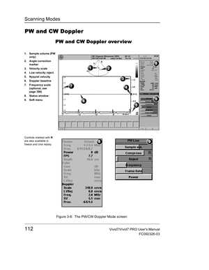 Page 126Scanning Modes
112Vivid7/Vivid7 PRO Users Manual
FC092326-03
PW and CW Doppler
PW and CW Doppler over view
 Figure 3-8: The PW/CW Doppler Mode screen 
1. Sample volume (PW 
only)
2. Angle correction 
marker
3. Velocity scale
4. Low velocity reject
5. Nyquist velocity
6. Doppler baseline
7. Frequency scale 
(optional, see 
page 398)
8. Status window:
9. Soft menu
Controls marked with R 
are also available in 
freeze and cine replay. 