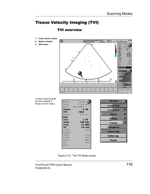 Page 133Scanning Modes
Vivid7/Vivid7 PRO Users Manual119
FC092326-03
Tissue Velocity Imaging (TVI)
TVI over view
 Figure 3-10: The TVI Mode screen 
1. Color sector marker
2. Status window:
3. Soft menu
Controls marked with R 
are also available in 
freeze and cine replay. 