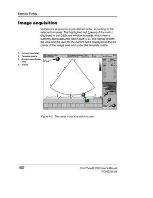 Page 164Stress Echo
150Vivid7/Vivid7 PRO Users Manual
FC092326-03
Image acquisition
Images are acquired in a pre-defined order, according to the 
selected template. The highlighted cell (green) of the matrix, 
displayed in the Clipboard window indicates which view is 
currently being acquired (see Figure 4-2). The names of both 
the view and the level for the current cell is displayed on the top 
corner of the image area and under the template matrix.
 Figure 4-2: The stress mode acquisition screen
1. Current...