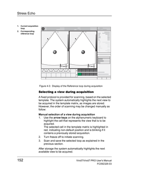 Page 166Stress Echo
152Vivid7/Vivid7 PRO Users Manual
FC092326-03
 Figure 4-3: Display of the Reference loop during acquisition
Selecting a view during acquisition
A fixed protocol is provided for scanning, based on the selected 
template. The system automatically highlights the next view to 
be acquired in the template matrix, as images are stored. 
However, the order of scanning may be changed manually as 
follow:
Manual selection of a view during acquisition
1. Use the arrow keys on the alphanumeric keyboard...