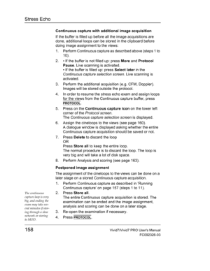 Page 172Stress Echo
158Vivid7/Vivid7 PRO Users Manual
FC092326-03
Continuous capture with additional image acquisition
If the buffer is filled up before all the image acquisitions are 
done, additional loops can be stored in the clipboard before 
doing image assignment to the views:
1. Perform Continuous capture as described above (steps 1 to 
10).
2. • If the buffer is not filled up: press More and Protocol 
Pause. Live scanning is activated.
• If the buffer is filled up: press Select later in the 
Continuous...