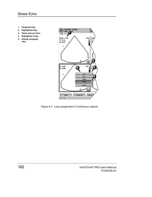 Page 176Stress Echo
162Vivid7/Vivid7 PRO Users Manual
FC092326-03
 Figure 4-7: Loop assignment in Continuous capture
1. Assigned loop
2. Highlighted loop
3. Views pop-up menu
4. Highlighted views
5. Already assigned 
view 