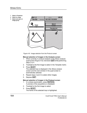 Page 178Stress Echo
164Vivid7/Vivid7 PRO Users Manual
FC092326-03
 Figure 4-8: Image selection from the Protocol screen
Manual selection of images in the Analysis screen
1. When currently in protocol analysis in the Stress analysis 
quad screen (Figure 4-9), hold down 
SHIFT while performing 
steps 2 to 4.
2. Trackball to the first image to select in the Template matrix.
3. Press 
SELECT.
The selected loop is displayed in the Stress analyze 
screen and the next window in the quad screen is 
automatically...